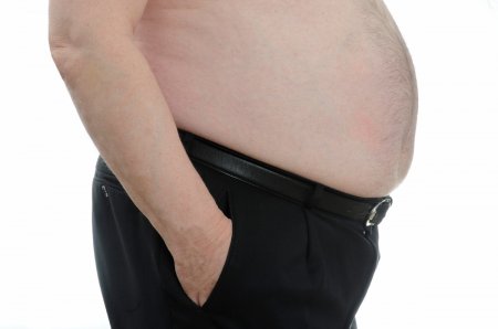 Ученые опровергли существующие стереотипы о здоровье людей с ожирением