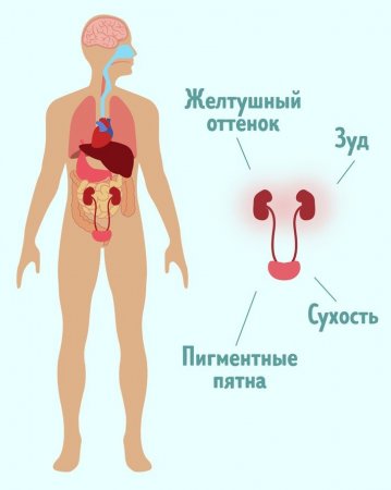 9 неочевидных симптомов, свидетельствующих о проблемах с почками