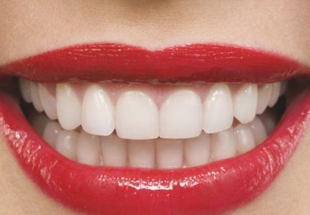 В Японии научились отбелять зубы без повреждения эмали