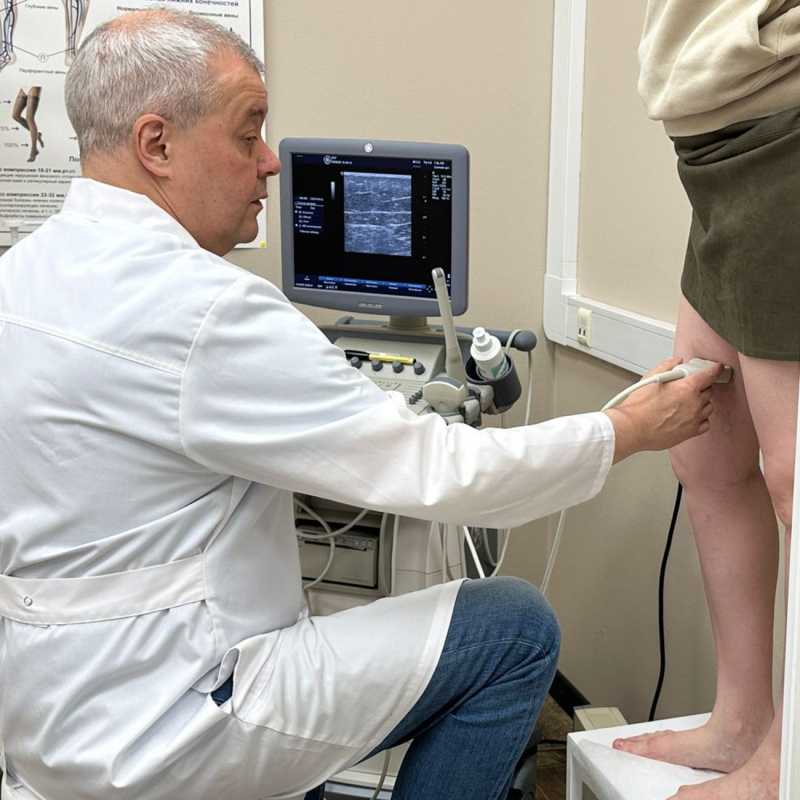 Заболевания вен: незаметная угроза, о которой важно помнить